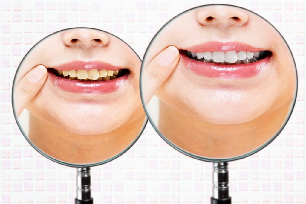 白金高輪・白金高輪リューズ歯科